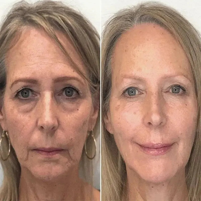 🔥2026, Exclusive premium LAOZIKTMCOMPLEX technology and sophisticated design 2-minute wrinkle-reducing serum( ✅ Permanently removes wrinkles in 3 minutes ✅ )