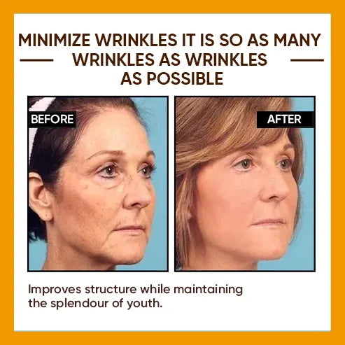 🔥2026, Exclusive premium LAOZIKTMCOMPLEX technology and sophisticated design 2-minute wrinkle-reducing serum( ✅ Permanently removes wrinkles in 3 minutes ✅ )
