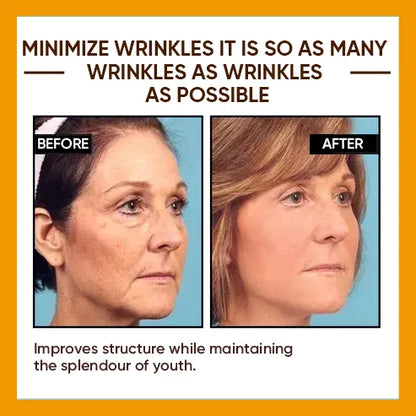 🔥2026, Exclusive premium LAOZIKTMCOMPLEX technology and sophisticated design 2-minute wrinkle-reducing serum( ✅ Permanently removes wrinkles in 3 minutes ✅ )