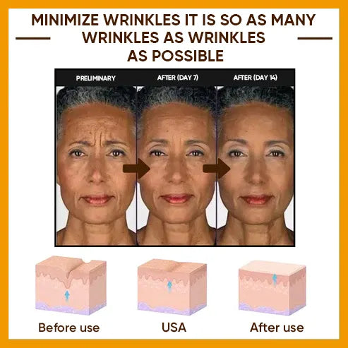 🔥2026, Exclusive premium LAOZIKTMCOMPLEX technology and sophisticated design 2-minute wrinkle-reducing serum( ✅ Permanently removes wrinkles in 3 minutes ✅ )