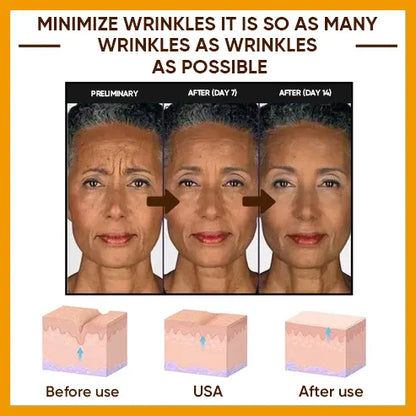 🔥2026, Exclusive premium LAOZIKTMCOMPLEX technology and sophisticated design 2-minute wrinkle-reducing serum( ✅ Permanently removes wrinkles in 3 minutes ✅ )