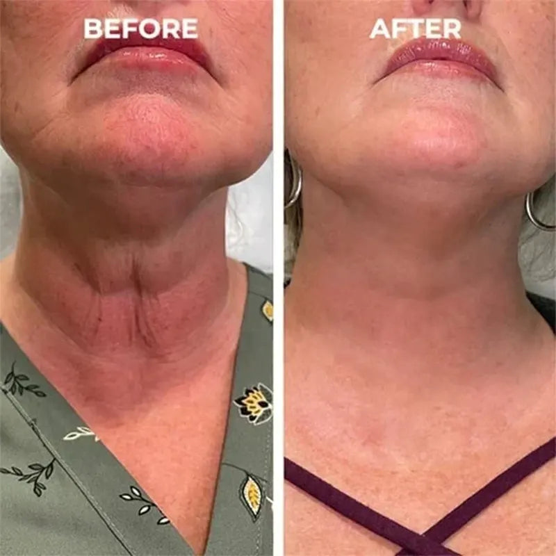 🔥2026, Exclusive premium LAOZIKTMCOMPLEX technology and sophisticated design 2-minute wrinkle-reducing serum( ✅ Permanently removes wrinkles in 3 minutes ✅ )