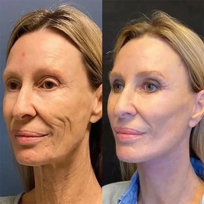 🔥2026, Exclusive premium LAOZIKTMCOMPLEX technology and sophisticated design 2-minute wrinkle-reducing serum( ✅ Permanently removes wrinkles in 3 minutes ✅ )