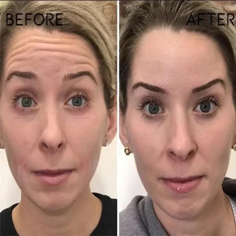 🔥2026, Exclusive premium LAOZIKTMCOMPLEX technology and sophisticated design 2-minute wrinkle-reducing serum( ✅ Permanently removes wrinkles in 3 minutes ✅ )