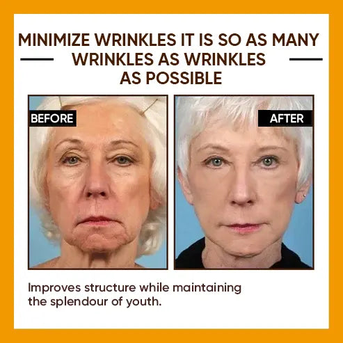 🔥2026, Exclusive premium LAOZIKTMCOMPLEX technology and sophisticated design 2-minute wrinkle-reducing serum( ✅ Permanently removes wrinkles in 3 minutes ✅ )