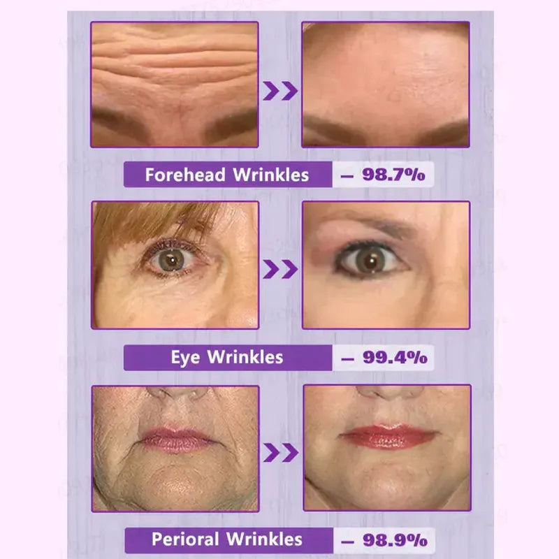 🔥2026, Exclusive premium LAOZIKTMCOMPLEX technology and sophisticated design 2-minute wrinkle-reducing serum( ✅ Permanently removes wrinkles in 3 minutes ✅ )