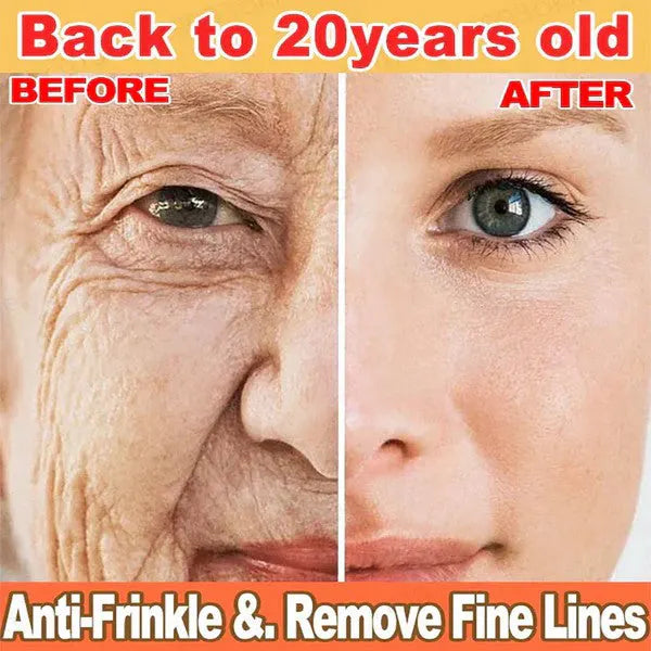 🔥2026, Exclusive premium LAOZIKTMCOMPLEX technology and sophisticated design 2-minute wrinkle-reducing serum( ✅ Permanently removes wrinkles in 3 minutes ✅ )